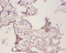 PRDX1 / Peroxiredoxin 1 Antibody - Immunohistochemistry of paraffin-embedded human placenta tissue using PRDX1 Antibody at dilution of 1:50