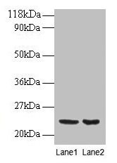 PRDX1 / Peroxiredoxin 1 Antibody - Western blot All lanes: perixiredoxin-1 antibody at 2µg/ml Lane 1: EC109 whole cell lysate Lane 2: 293T whole cell lysate Secondary Goat polyclonal to rabbit IgG at 1/15000 dilution Predicted band size: 21.9 kDa Observed band size: 21.9 kDa