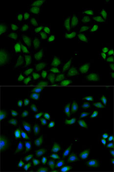 PRDX1 / Peroxiredoxin 1 Antibody - Immunofluorescence analysis of HeLa cells using PRDX1 antibody. Blue: DAPI for nuclear staining.