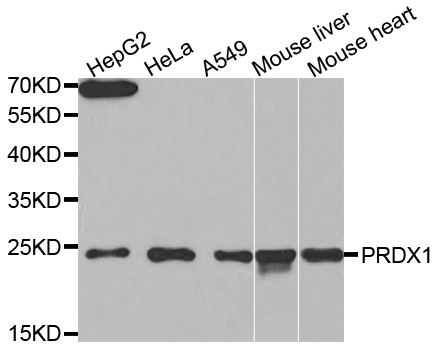 PRDX1 / Peroxiredoxin 1 Antibody - Western blot analysis of extracts of various cell lines, using PRDX1 antibody at 1:1000 dilution. The secondary antibody used was an HRP Goat Anti-Rabbit IgG (H+L) at 1:10000 dilution. Lysates were loaded 25ug per lane and 3% nonfat dry milk in TBST was used for blocking.