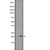PRDX1 / Peroxiredoxin 1 Antibody - Western blot analysis of PRDX1 expression in A431 whole cells lysate. The lane on the left is treated with the antigen-specific peptide.