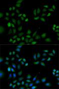 PRDX1 / Peroxiredoxin 1 Antibody - Immunofluorescence analysis of HeLa cells using PRDX1 Polyclonal Antibody.