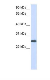 PRDX1 / Peroxiredoxin 1 Antibody - 293T cell lysate. Antibody concentration: 1.0 ug/ml. Gel concentration: 12%.  This image was taken for the unconjugated form of this product. Other forms have not been tested.