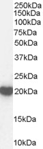 PRDX2 / Peroxiredoxin 2 Antibody - PRDX2 / Peroxiredoxin 2 antibody (1µg/ml) staining of Human Brain lysate (35µg protein in RIPA buffer). Detected by chemiluminescence.