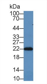PRDX2 / Peroxiredoxin 2 Antibody - Western Blot; Sample: Rat Brain lysate; Primary Ab: 2µg/mL Rabbit Anti-Rat PRDX2 Antibody Second Ab: 0.2µg/mL HRP-Linked Caprine Anti-Rabbit IgG Polyclonal Antibody