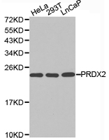 PRDX2 / Peroxiredoxin 2 Antibody - Western blot of extracts of various cell lines, using PRDX2 antibody.