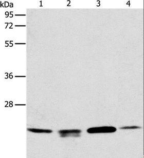 PRDX2 / Peroxiredoxin 2 Antibody - Western blot analysis of 293T, HeLa and PC3 cell, human liver cancer tissue, using PRDX2 Polyclonal Antibody at dilution of 1:750.