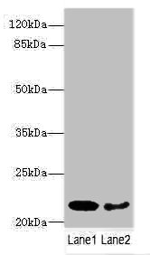 PRDX2 / Peroxiredoxin 2 Antibody - Western blot All Lanes: PRDX2 antibody at 9ug/ml Lane 1: Mouse liver tissue Lane 2: Mouse spleen tissue Secondary Goat polyclonal to rabbit IgG at 1/10000 dilution Predicted band size: 22,16 kDa Observed band size: 22 kDa