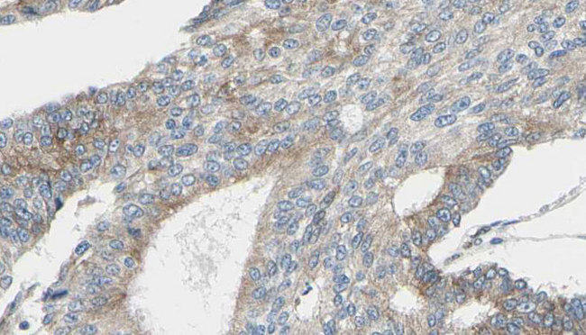 PRDX2 / Peroxiredoxin 2 Antibody - 1:100 staining human prostate tissue by IHC-P. The sample was formaldehyde fixed and a heat mediated antigen retrieval step in citrate buffer was performed. The sample was then blocked and incubated with the antibody for 1.5 hours at 22°C. An HRP conjugated goat anti-rabbit antibody was used as the secondary.