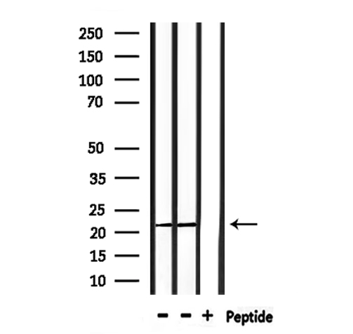 PRDX2 / Peroxiredoxin 2 Antibody - Western blot analysis of extracts of rat muscle, mouse spleen using PRDX2 antibody.