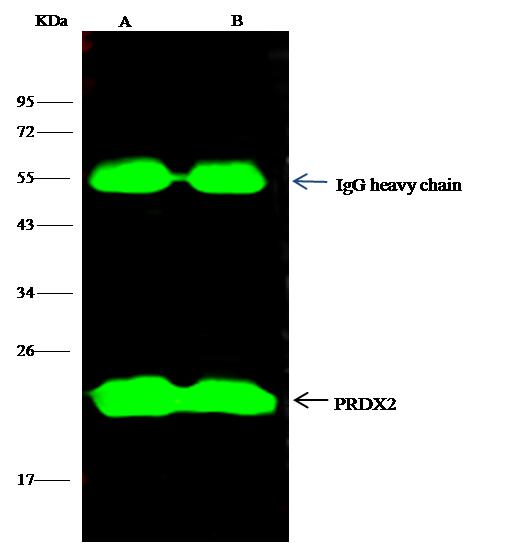 PRDX2 / Peroxiredoxin 2 Antibody - PRDX2 was immunoprecipitated using: Lane A: 0.5 mg Jurkat Whole Cell Lysate. Lane B: 0.5 mg HepG2 Whole Cell Lysate. 4 uL anti-PRDX2 rabbit polyclonal antibody and 15 ul of 50% Protein G agarose. Primary antibody: Anti-PRDX2 rabbit polyclonal antibody, at 1:100 dilution. Secondary antibody: Dylight 800-labeled antibody to rabbit IgG (H+L), at 1:5000 dilution. Developed using the odssey technique. Performed under reducing conditions. Predicted band size: 22 kDa. Observed band size: 22 kDa.