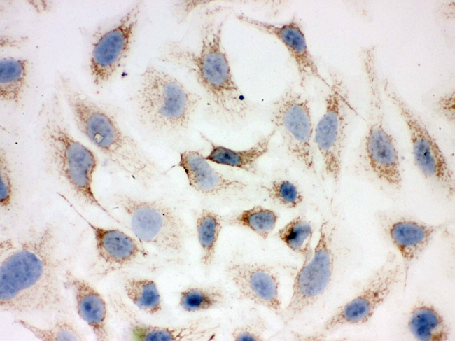 PRDX3 / Peroxiredoxin 3 Antibody - IHC analysis of Peroxiredoxin 3 using anti-Peroxiredoxin 3 antibody. Peroxiredoxin 3 was detected in immunocytochemical section of Hela cell. Heat mediated antigen retrieval was performed in citrate buffer (pH6, epitope retrieval solution) for 20 mins. The tissue section was blocked with 10% goat serum. The tissue section was then incubated with 1µg/ml rabbit anti-Peroxiredoxin 3 Antibody overnight at 4°C. Biotinylated goat anti-rabbit IgG was used as secondary antibody and incubated for 30 minutes at 37°C. The tissue section was developed using Strepavidin-Biotin-Complex (SABC) with DAB as the chromogen.
