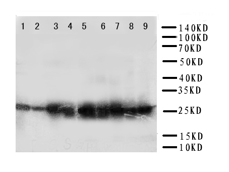 PRDX3 / Peroxiredoxin 3 Antibody - WB of PRDX3 / Peroxiredoxin 3 antibody. Lane 1: Rat Brain Tissue Lysate. Lane 2: Rat Lung Tissue Lysate. Lane 3: Rat Liver Tissue Lysate . Lane 4: Rat Kidney Tissue Lysate. Lane 5: HELA Cell Lysate . Lane 6: JURKAT Cell Lysate. Lane 7: 293T Cell Lysate. Lane 8: MCF-7 Cell Lysate. Lane 9: A549 Cell Lysate.
