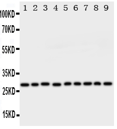 PRDX3 / Peroxiredoxin 3 Antibody - Anti-Peroxiredoxin 3 antibody, Western blotting All lanes: Anti Peroxiredoxin 3 at 0.5ug/ml Lane 1: Rat Brain Tissue Lysate at 50ug Lane 2: Rat Lung Tissue Lysate at 50ug Lane 3: Rat Liver Tissue Lysate at 50ug Lane 4: Rat Kidney Tissue Lysate at 50ug Lane 5: HELA Whole Cell Lysate at 40ug Lane 6: JURKAT Whole Cell Lysate at 40ug Lane 7: 293T Whole Cell Lysate at 40ug Lane 8: MCF-7 Whole Cell Lysate at 40ug Lane 9: A549 Whole Cell Lysate at 40ug Predicted bind size: 28KD Observed bind size: 28KD