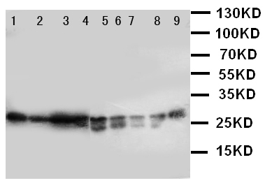 PRDX3 / Peroxiredoxin 3 Antibody - WB of PRDX3 / Peroxiredoxin 3 antibody. Lane 1: Rat Brain Tissue Lysate. Lane 2: Rat Lung Tissue Lysate. Lane 3: Rat Kidney Tissue Lysate. Lane 4: HELA Cell Lysate. Lane 5: JURKAT Cell Lysate. Lane 6: 293T Cell Lysate. Lane 7: MCF-7 Cell Lysate. Lane 8: A549 Cell Lysate..