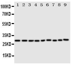 PRDX3 / Peroxiredoxin 3 Antibody - Anti-Peroxiredoxin 3 antibody, Western blotting All lanes: Anti Peroxiredoxin 3 at 0.5ug/ml Lane 1: Rat Brain Tissue Lysate at 50ugLane 2: Rat Lung Tissue Lysate at 50ugLane 3: Rat Kidney Tissue Lysate at 50ugLane 4: HELA Whole Cell Lysate at 40ugLane 5: JURKAT Whole Cell Lysate at 40ugLane 6: 293T Whole Cell Lysate at 40ugLane 7: MCF-7 Whole Cell Lysate at 40ugLane 8: A549 Whole Cell Lysate at 40ugLane 9: U20S Whole Cell Lysate at 40ugPredicted bind size: 28KD Observed bind size: 28KD