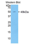 PRDX3 / Peroxiredoxin 3 Antibody - Western blot of recombinant PRDX3 / Peroxiredoxin 3.  This image was taken for the unconjugated form of this product. Other forms have not been tested.