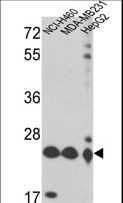 PRDX3 / Peroxiredoxin 3 Antibody - Western blot of PRDX3 Antibody in NCI-H460,MDA-MB231,HepG2 cell line lysates (35 ug/lane). PRDX3 (arrow) was detected using the purified antibody.(2 ug/ml)