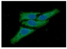 PRDX3 / Peroxiredoxin 3 Antibody - ICC/IF analysis of Peroxiredoxin3 in HeLa cells line, stained with DAPI (Blue) for nucleus staining and monoclonal anti-human Peroxiredoxin3 antibody (1:100) with goat anti-mouse IgG-Alexa fluor 488 conjugate (Green).