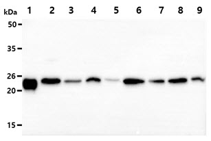 PRDX3 / Peroxiredoxin 3 Antibody - The recombinant human PRDX3 protein (50ng) and Cell lysates (40ug) were resolved by SDS-PAGE, transferred to PVDF membrane and probed with anti-human Peroxiredoxin3 antibody (1:1000). Proteins were visualized using a goat anti-mouse secondary antibody conjugated to HRP and an ECL detection system. Lane 1.: Recombinant protein Lane 2.: HeLa cell lysate Lane 3.: HepG2 cell lysate Lane 4.: TF1 cell lysate Lane 5.: U87MG cell lysate Lane 6.: Raji cell lysate Lane 7.: 293T cell lysate Lane 8.: Jurkat cell lysate Lane 9.: MCF7 cell lysate