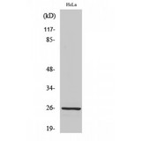 PRDX3 / Peroxiredoxin 3 Antibody - Western blot of PRX III antibody