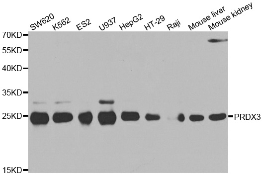 PRDX3 / Peroxiredoxin 3 Antibody - Western blot analysis of extracts of various cell lines.