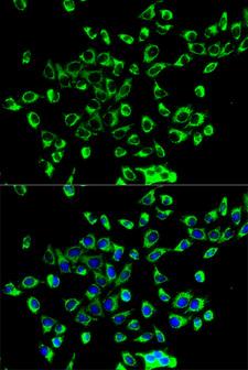PRDX3 / Peroxiredoxin 3 Antibody - Immunofluorescence analysis of HeLa cells.