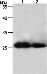 PRDX3 / Peroxiredoxin 3 Antibody - Western blot analysis of HeLa and 293T cell, using PRDX3 Polyclonal Antibody at dilution of 1:800.