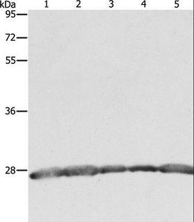 PRDX3 / Peroxiredoxin 3 Antibody - Western blot analysis of HeLa, 293T and MCF7 cell, human fetal brain tissue and Jurkat cell, using PRDX3 Polyclonal Antibody at dilution of 1:800.