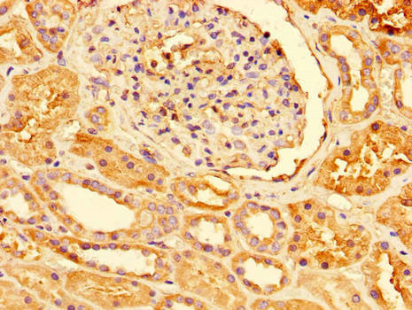 PRDX3 / Peroxiredoxin 3 Antibody - Immunohistochemistry of paraffin-embedded human renal tissue using PRDX3 Antibody at dilution of 1:100