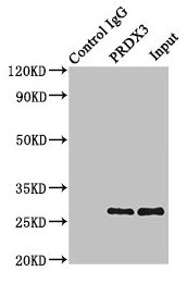 PRDX3 / Peroxiredoxin 3 Antibody