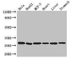 PRDX3 / Peroxiredoxin 3 Antibody - Western Blot Positive WB detected in: Hela whole cell lysate, HepG2 whole cell lysate, MCF-7 whole cell lysate, Mouse heart tissue, Mouse liver tissue, Mouse stomach tissue All lanes: PRDX3 antibody at 3.2µg/ml Secondary Goat polyclonal to rabbit IgG at 1/50000 dilution Predicted band size: 28, 26 kDa Observed band size: 28 kDa