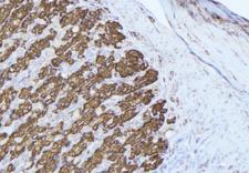 PRDX3 / Peroxiredoxin 3 Antibody - 1:100 staining human gastric tissue by IHC-P. The sample was formaldehyde fixed and a heat mediated antigen retrieval step in citrate buffer was performed. The sample was then blocked and incubated with the antibody for 1.5 hours at 22°C. An HRP conjugated goat anti-rabbit antibody was used as the secondary.