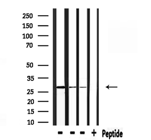 PRDX3 / Peroxiredoxin 3 Antibody - Western blot analysis of extracts of rat brain, rat spleen, mouse spleen using PRDX3 antibody.