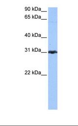 PRDX3 / Peroxiredoxin 3 Antibody - Jurkat cell lysate. Antibody concentration: 0.5 ug/ml. Gel concentration: 12%.  This image was taken for the unconjugated form of this product. Other forms have not been tested.