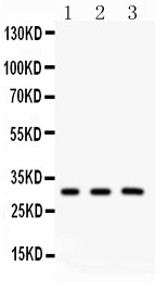 PRDX4 / Peroxiredoxin 4 Antibody - Peroxiredoxin 4 antibody Western blot. All lanes: Anti Peroxiredoxin 4 at 0.5 ug/ml. Lane 1: Rat Brain Tissue Lysate at 50 ug. Lane 2: Mouse Brain Tissue Lysate at 50 ug. Lane 3: HELA Whole Cell Lysate at 40 ug. Predicted band size: 31 kD. Observed band size: 31 kD.