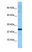 PRDX4 / Peroxiredoxin 4 Antibody - PRDX4 / Peroxiredoxin 4 antibody Western Blot of Fetal Heart.  This image was taken for the unconjugated form of this product. Other forms have not been tested.
