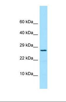 PRDX4 / Peroxiredoxin 4 Antibody - Western blot of Human COLO205. PRDX4 antibody dilution 1.0 ug/ml.  This image was taken for the unconjugated form of this product. Other forms have not been tested.