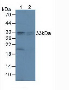 PRDX4 / Peroxiredoxin 4 Antibody - Western Blot; Lane1: Rat Brain Tissue; Lane2: Rat Lung Tissue.