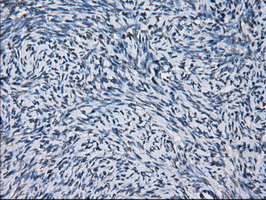 PRDX4 / Peroxiredoxin 4 Antibody - IHC of paraffin-embedded Human Ovary tissue using anti-PRDX4 mouse monoclonal antibody.