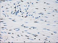 PRDX4 / Peroxiredoxin 4 Antibody - IHC of paraffin-embedded Human colon tissue using anti-PRDX4 mouse monoclonal antibody.
