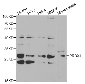 PRDX4 / Peroxiredoxin 4 Antibody - Western blot analysis of extracts of various cell lines, using PRDX4 antibody at 1:1000 dilution. The secondary antibody used was an HRP Goat Anti-Rabbit IgG (H+L) at 1:10000 dilution. Lysates were loaded 25ug per lane and 3% nonfat dry milk in TBST was used for blocking.