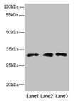 PRDX4 / Peroxiredoxin 4 Antibody - Western blot All lanes: PRDX4 antibody at 8µg/ml Lane 1: HepG2 whole cell lysate Lane 2: Hela whole cell lysate Lane 3: 293T whole cell lysate Secondary Goat polyclonal to rabbit IgG at 1/10000 dilution Predicted band size: 31 kDa Observed band size: 31 kDa