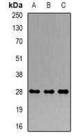 PRDX4 / Peroxiredoxin 4 Antibody - Western blot analysis of PRDX4 expression in HeLa (A); MCF7 (B); mouse testis (C) whole cell lysates.