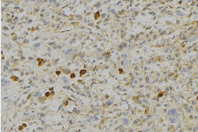 PRDX4 / Peroxiredoxin 4 Antibody - 1:100 staining human gastric tissue by IHC-P. The sample was formaldehyde fixed and a heat mediated antigen retrieval step in citrate buffer was performed. The sample was then blocked and incubated with the antibody for 1.5 hours at 22°C. An HRP conjugated goat anti-rabbit antibody was used as the secondary.