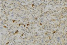 PRDX4 / Peroxiredoxin 4 Antibody - 1:100 staining human gastric tissue by IHC-P. The sample was formaldehyde fixed and a heat mediated antigen retrieval step in citrate buffer was performed. The sample was then blocked and incubated with the antibody for 1.5 hours at 22°C. An HRP conjugated goat anti-rabbit antibody was used as the secondary.