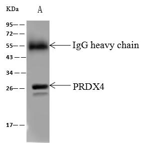PRDX4 / Peroxiredoxin 4 Antibody - PRDX4 was immunoprecipitated using: Lane A: 0.5 mg HeLa Whole Cell Lysate. 4 uL anti-PRDX4 rabbit polyclonal antibody and 60 ug of Immunomagnetic beads Protein A/G. Primary antibody: Anti-PRDX4 rabbit polyclonal antibody, at 1:100 dilution. Secondary antibody: Goat Anti-Rabbit IgG (H+L)/HRP at 1/10000 dilution. Developed using the ECL technique. Performed under reducing conditions. Predicted band size: 31 kDa. Observed band size: 28 kDa.