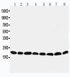 PRDX5 / Peroxiredoxin 5 Antibody - WB of PRDX5 / Peroxiredoxin 5 antibody. All lanes: Anti-PRDX5 at 0.5ug/ml. Lane 1: Rat Brain Tissue Lysate at 40ug. Lane 2: Rat Lung Tissue Lysate at 40ug. Lane 3: Rat Liver Tissue Lysate at 40ug. Lane 4: Rat Kidney Tissue Lysate at 40ug. Lane 5: HELA Whole Cell Lysate at 40ug. Lane 6: 293T Whole Cell Lysate at 40ug. Lane 7: MCF-7 Whole Cell Lysate at 40ug. Lane 8: A549 Whole Cell Lysate at 40ug. Predicted bind size: 22KD. Observed bind size: 18KD.