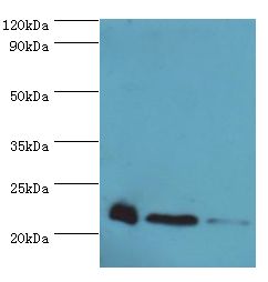 PRDX5 / Peroxiredoxin 5 Antibody - Western blot. All lanes: PRDX5 antibody at 4 ug/ml. Lane 1: mouse brain tissue. Lane 2: HeLa whole cell lysate. Lane 3: 293T whole cell lysate. Secondary antibody: Goat polyclonal to rabbit at 1:10000 dilution. Predicted band size: 22 kDa. Observed band size: 22 kDa.