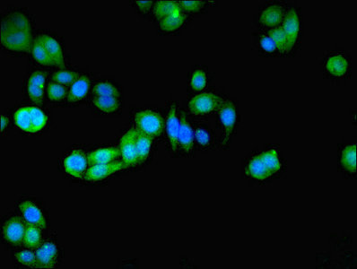 PRDX5 / Peroxiredoxin 5 Antibody - Immunofluorescent analysis of PC-3 cells using PRDX5 Antibody at dilution of 1:100 and Alexa Fluor 488-congugated AffiniPure Goat Anti-Rabbit IgG(H+L)